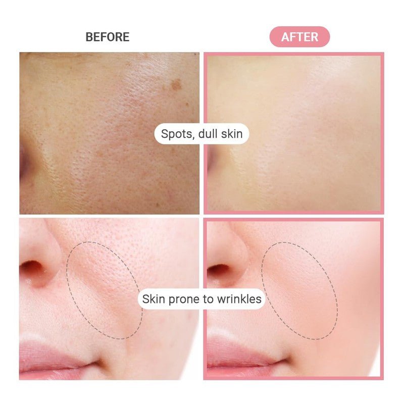 TenZero Hydronic Acid & Niacinamide Heart Serum Pad – Made in Korea